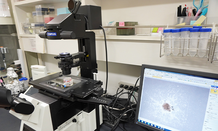 シャルコー・マリー・トゥース病の疾患モデル細胞を顕微鏡で観察している様子