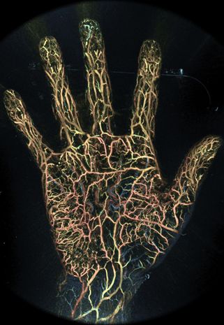 Example of hand imaging. Differentiation between arteries and veins can be made by displaying the oxygen saturation of the blood in colors.